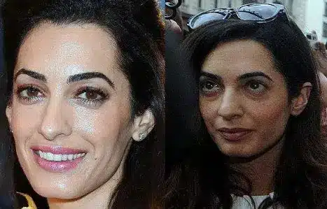 Amal Clooney Before After