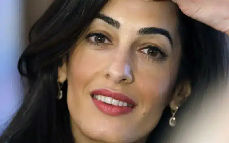 Amal Clooney’s Cosmetic Surgery Rumor